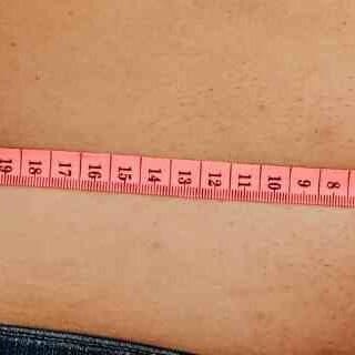 Weight loss services in Pembroke, Wales